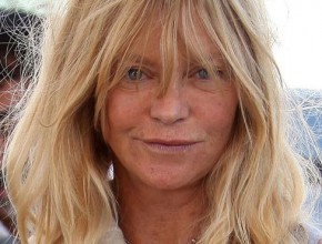 Goldie Hawn after plastic surgery 05