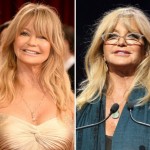 Goldie Hawn before and after plastic surgery 02