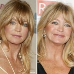 Goldie Hawn before and after plastic surgery