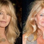 Goldie Hawn before and after plastic surgery 05