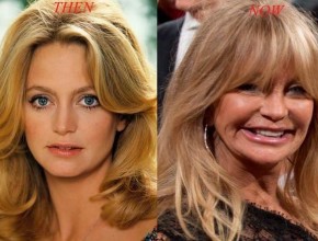 Goldie Hawn before and after plastic surgery