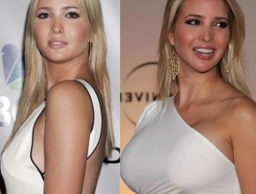 Ivanka Trump before and after breast augmentation