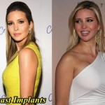 Ivanka Trump before and after breast implants