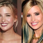 Ivanka Trump before and after plastic surgery 05