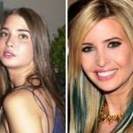 Ivanka Trump before and after plastic surgery