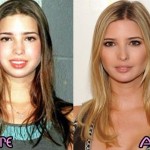 Ivanka Trump before and after plastic surgery 2