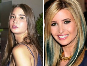 Ivanka Trump before and after plastic surgery