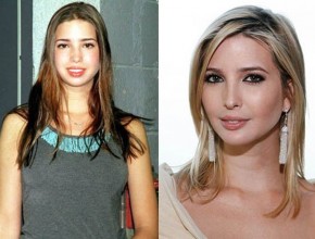 Ivanka Trump before and after plastic surgery