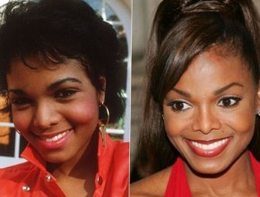 Janet Jackson before and after plastic surgery 03