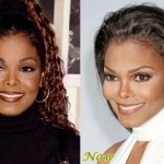 Janet Jackson before and after plastic surgery 05