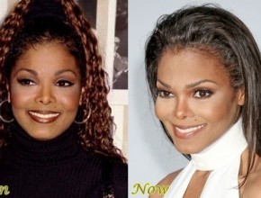 Janet Jackson before and after plastic surgery 05
