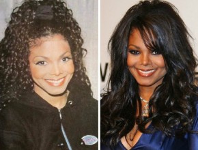 Janet Jackson before and after plastic surgery