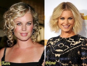 Rebecca Romijn before and after plastic surgery