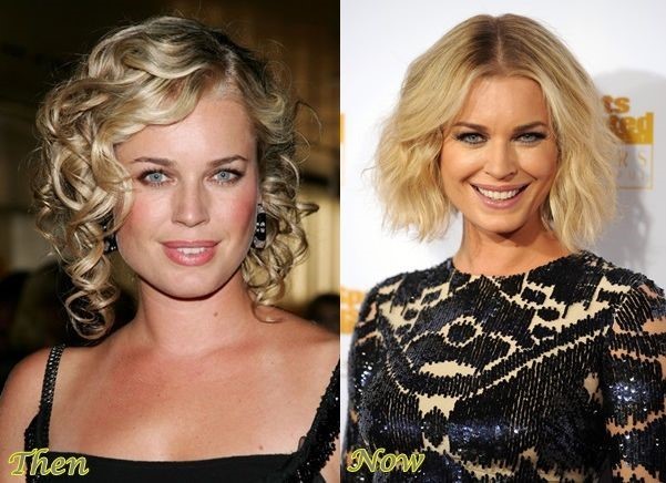 Rebecca Romijn before and after plastic surgery