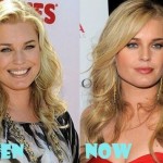 Rebecca Romijn before and after plastic surgery 02