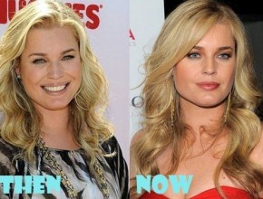 Rebecca Romijn before and after plastic surgery 02