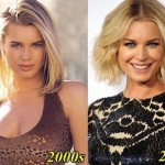 Rebecca Romijn before and after plastic surgery 03