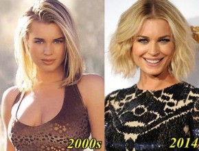 Rebecca Romijn before and after plastic surgery 03