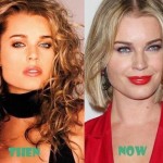 Rebecca Romijn before and after plastic surgery