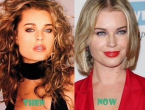 Rebecca Romijn before and after plastic surgery