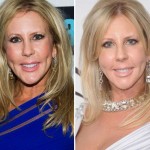 Vicki Gunvalson before and after plastic surgery 01