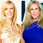 Vicki Gunvalson before and after plastic surgery