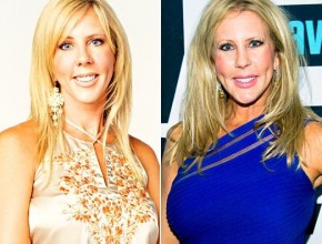 Vicki Gunvalson before and after plastic surgery