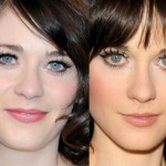 Zooey Deschanel before and after eyelid surgery