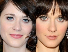 Zooey Deschanel before and after eyelid surgery