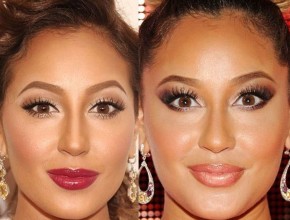 Adrienne Bailon after using Botox