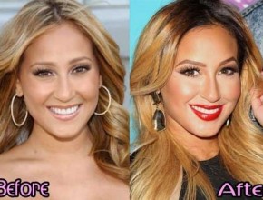Adrienne Bailon before and after plastic surgery 02