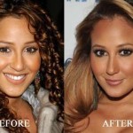 Adrienne Bailon before and after plastic surgery 03