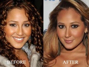 Adrienne Bailon before and after plastic surgery 03