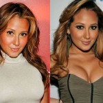 Adrienne Bailon before and after plastic surgery