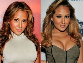 Adrienne Bailon before and after plastic surgery