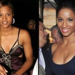 Ciara before and after breast augmentation