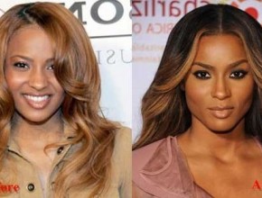 Ciara before and after nose job 02