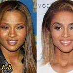 Ciara before and after nose job 03