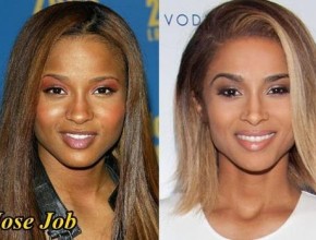 Ciara before and after nose job 03