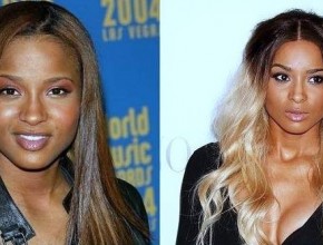 Ciara before and after nose job and breast augmentation