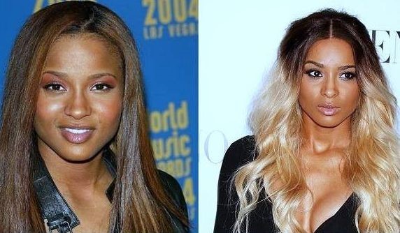 Ciara before and after nose job and breast augmentation
