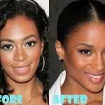 Ciara before and after plastic surgery