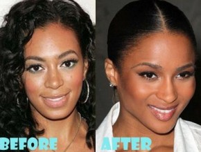 Ciara before and after plastic surgery