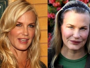 Daryl Hannah before and after plastic surgery 01