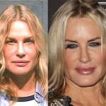 Daryl Hannah before and after plastic surgery 02