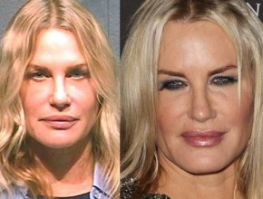 Daryl Hannah before and after plastic surgery 02