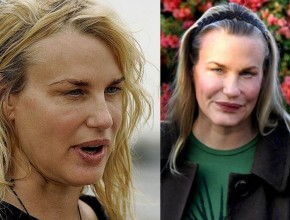 Daryl Hannah before and after plastic surgery