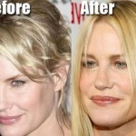 Daryl Hannah before and after plastic surgery 04