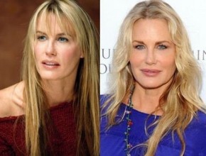 Daryl Hannah before and after plastic surgery 05