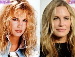 Daryl Hannah before and after plastic surgery 06